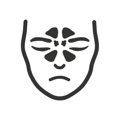 Sinusitis