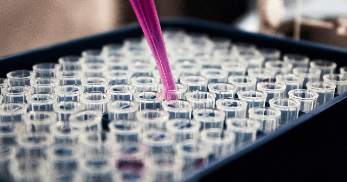 What is the Bone Profile Blood Test All you need to know