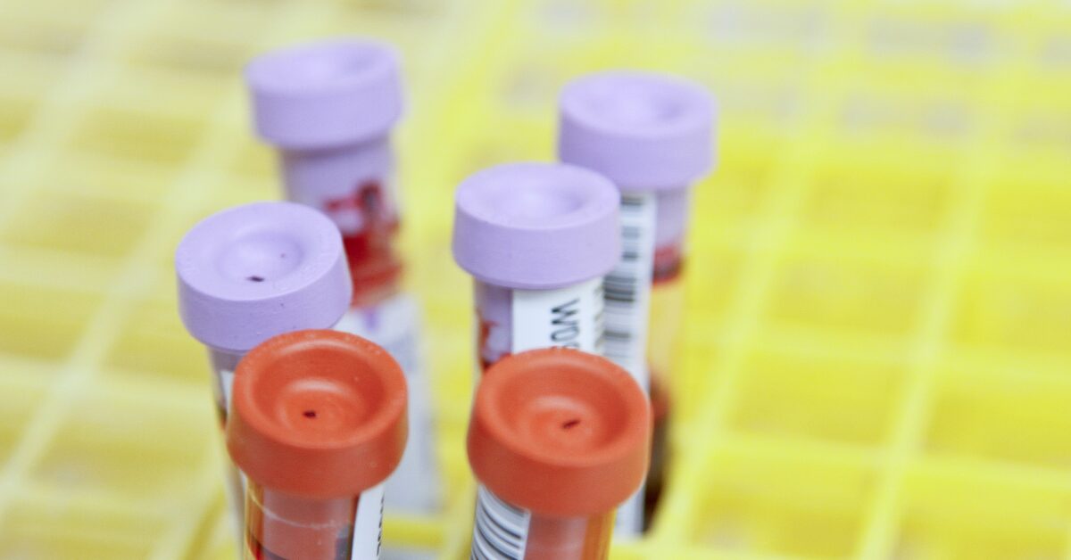 Wondering if a blood test can detect cancer? Explore how liquid biopsies, tumor markers, and genetic tests help in early cancer detection and diagnosis.