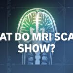 What Do MRI Scans Show?